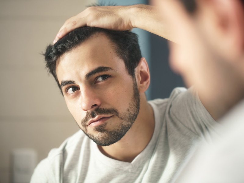 man looking at hair line in mirror